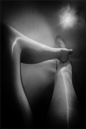 Leg Lines