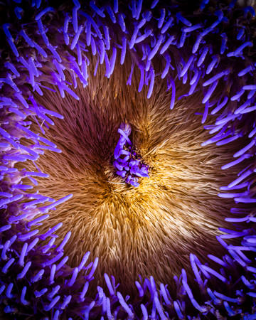 Artichoke